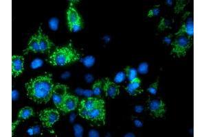 Anti-AK4 mouse monoclonal antibody (ABIN2454868) immunofluorescent staining of COS7 cells transiently transfected by pCMV6-ENTRY AK4 (RC220572). (AK4 Antikörper)