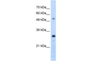 Western Blotting (WB) image for anti-PSME3 (PSME3) antibody (ABIN2462949) (PSME3 Antikörper)