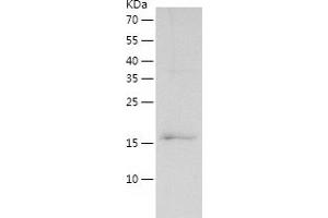 Western Blotting (WB) image for Cardiac Troponin C (TNNC1) (AA 1-161) protein (His-IF2DI Tag) (ABIN7122145)