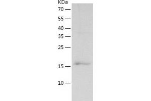 Western Blotting (WB) image for Cardiac Troponin C (TNNC1) (AA 1-161) protein (His tag) (ABIN7122145)