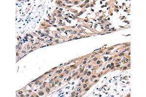 Immunohistochemistry (IHC) image for anti-Gap Junction Protein, beta 2, 26kDa (GJB2) antibody (ABIN2425961) (GJB2 Antikörper)