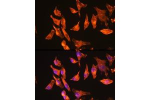 Immunofluorescence analysis of HeLa cells using α-Actin-1  Rabbit mAb (ABIN3015986, ABIN3015987, ABIN1680683 and ABIN1680684) at dilution of 1:100 (40x lens). (Actin Antikörper)