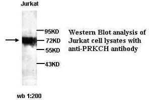 Image no. 1 for anti-Protein Kinase C, eta (PRKCH) antibody (ABIN790881) (PKC eta Antikörper)