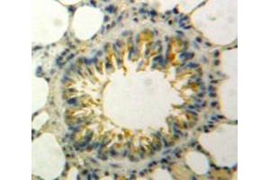 Immunohistochemistry (IHC) image for anti-Fibroblast Growth Factor 21 (FGF21) (AA 29-209) antibody (ABIN1867952)
