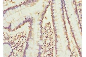Immunohistochemistry of paraffin-embedded human small intestine tissue using ABIN7149242 at dilution of 1:100 (CYP2C18 Antikörper  (AA 231-490))