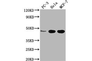 Western Blot Positive WB detected in: PC-3 whole cell lysate, Hela whole cell lysate, MCF-7 whole cell lysate All lanes: CCDC74B antibody at 1:2000 Secondary Goat polyclonal to rabbit IgG at 1/50000 dilution Predicted band size: 42, 36 kDa Observed band size: 42 kDa (CCDC74B Antikörper  (AA 1-257))