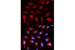 Immunofluorescence analysis of U2OS cells using PPARD antibody. (PPARD Antikörper)