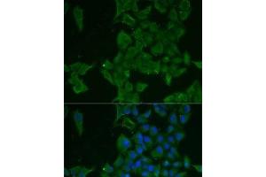 Immunofluorescence analysis of MCF7 cells using LGALS3BP Polyclonal Antibody (LGALS3BP Antikörper)
