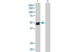 Western Blot analysis of SMPDL3B expression in transfected 293T cell line by SMPDL3B MaxPab polyclonal antibody. (SMPDL3B Antikörper  (AA 1-373))