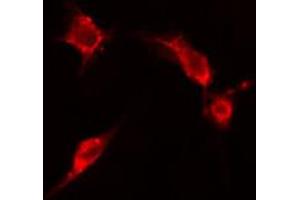 ABIN6266602 staining HepG2 cells by IF/ICC. (ENO2/NSE Antikörper  (C-Term))