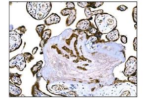 IHC analysis of IGF2R using anti-IGF2R antibody (ABIN7601705). (IGF2R Antikörper  (AA 424-529))