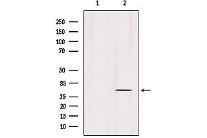 Western blot analysis of extracts from 293, using ECHS1 Antibody.