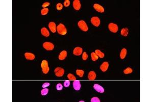 Immunofluorescence analysis of U-2 OS cells using Symmetric DiMethyl-Histone H3-R2 Polyclonal Antibody at dilution of 1:100 (40x lens). (Histone 3 Antikörper  (H3R2me2s))