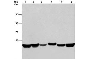 Western Blot analysis of LoVo and A375 cell, Mouse brain tissue, HepG2, A431 and Hela cell using HNRNPH1 Polyclonal Antibody at dilution of 1:350 (HNRNPH1 Antikörper)