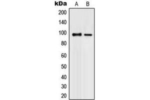 Western blot analysis of PML expression in K562 (A), COLO320 (B) whole cell lysates. (PML Antikörper  (N-Term))
