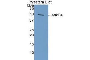Western blot analysis of the recombinant protein. (PAI1 Antikörper  (AA 25-402))