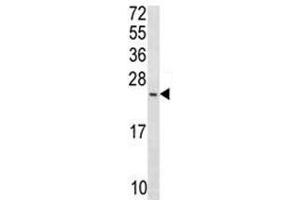 Anti-Bax antibody western blot analysis in T47D lysate