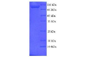 Microtubule-Associated Protein tau (MAPT) (AA 2-752), (full length) protein (His tag) (MAPT Protein (AA 2-752, full length) (His tag))