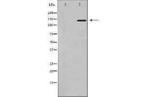 Western blot analysis of MDR1 using HT-29 whole cell lysates,The lane on the left is treated with the antigen-specific peptide. (ABCB1 Antikörper  (Internal Region))