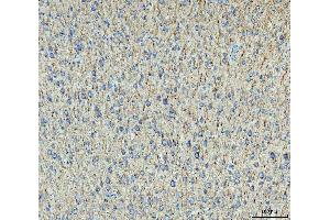 IHC analysis of MAP2 using anti-MAP2 antibody (ABIN7601483). (MAP2 Antikörper  (AA 360-1101))