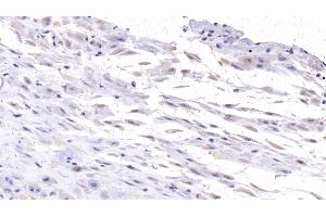 Detection of DSG3 in Human Placenta Tissue using Monoclonal Antibody to Desmoglein 3 (DSG3) (Desmoglein 3 Antikörper  (AA 334-604))