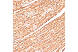 Immunohistochemistry of paraffin-embedded mouse heart using CYB5A antibody (ABIN6130832, ABIN6139296, ABIN6139297 and ABIN6221049) at dilution of 1:100 (40x lens). (CYB5A Antikörper  (AA 1-100))