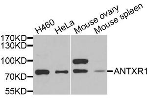 Western blot analysis of extracts of various cell lines, using ANTXR1 antibody. (ANTXR1 Antikörper)