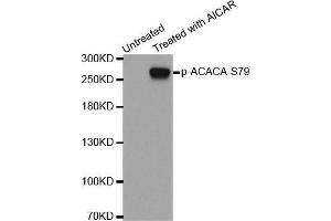 Western blot analysis of extracts from 293 cells using Phospho-ACACA-S79 antibody. (Acetyl-CoA Carboxylase alpha Antikörper  (pSer79))