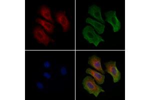 ABIN6261612 and ABIN6279424 staining Hela cells by IF/ICC. (ETAA1 Antikörper  (Internal Region))