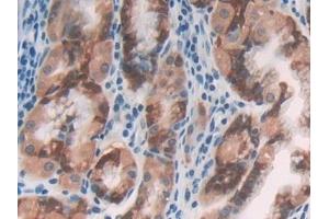 Immunohistochemistry (IHC) image for anti-Cartilage Intermediate Layer Protein, Nucleotide Pyrophosphohydrolase (CILP) (AA 603-846) antibody (ABIN7439468)