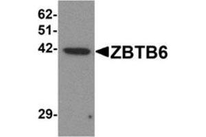 Western blot analysis of ZBTB6 in EL4 cell lysate with ZBTB6 antibody at 1 μg/ml.