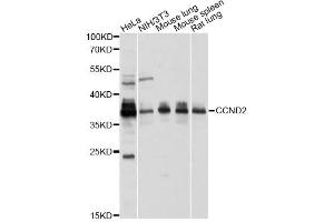 Western blot analysis of extracts of various cell lines, using CCND2 antibody (ABIN1875413) at 1:1000 dilution. (Cyclin D2 Antikörper)