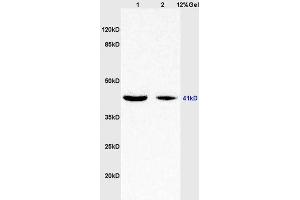 Lane 1: rat brain lysates Lane 2: human colon carcinoma lysates probed with Anti WNT7A Polyclonal Antibody, Unconjugated (ABIN719336) at 1:200 in 4 °C.