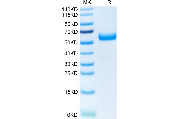 TREM2 Protein (AA 19-174) (Fc Tag)
