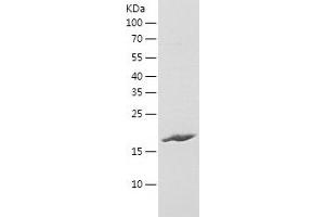 Western Blotting (WB) image for Immunoglobulin Superfamily Containing Leucine Rich Repeat Protein (ISLR) (AA 111-275) protein (His tag) (ABIN7123409) (ISLR Protein (AA 111-275) (His tag))