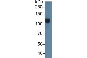 Detection of C5a in Porcine Serum using Polyclonal Antibody to Complement Component 5a (C5a) (C5A Antikörper  (AA 1-74))