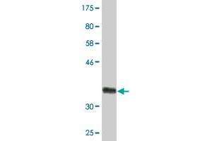 Western Blot detection against Immunogen (35. (HSD3B2 Antikörper  (AA 33-122))