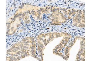 ABIN6265370 and ABIN6272981 at 1/100 staining Rat ovary tissue by IHC-P. (SULT1E1 Antikörper  (Internal Region))