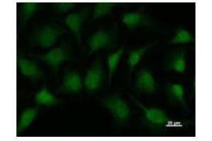 Immunostaining analysis in HeLa cells. (SMAD1 Antikörper)
