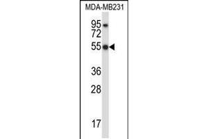Western blot analysis in MDA-MB231 cell line lysates (35ug/lane). (HCLS1 Antikörper  (C-Term))