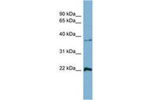 Image no. 1 for anti-RAN, Member RAS Oncogene Family (RAN) (AA 143-192) antibody (ABIN6741892) (RAN Antikörper  (AA 143-192))