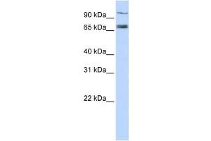 Western Blotting (WB) image for anti-Transporter 1, ATP-Binding Cassette, Sub-Family B (MDR/TAP) (TAP1) antibody (ABIN2458765) (TAP1 Antikörper)