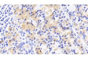 Detection of AGMAT in Human Stomach Tissue using Polyclonal Antibody to Agmatine Ureohydrolase (AGMAT)