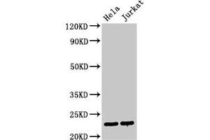 Western Blot Positive WB detected in: Hela whole cell lysate, Jurkat whole cell lysate All lanes: PTTG1 antibody at 3 μg/mL Secondary Goat polyclonal to rabbit IgG at 1/50000 dilution Predicted band size: 23 kDa Observed band size: 23 kDa (PTTG1 Antikörper  (AA 2-202))