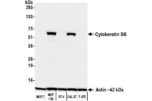 Western Blotting (WB) image for anti-Keratin 5/6 (KRT5/6) (C-Term) antibody (ABIN7795769) (Rekombinanter Keratin 5/6 Antikörper  (C-Term))