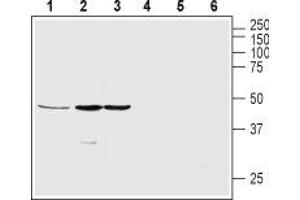 Western blot analysis of rat pancreas (lanes 1 and 4), SH-SY5Y (lanes 2 and 5) and MS1 (lanes 3 and 6) lysates: - 1-3. (GHSR Antikörper  (2nd Extracellular Loop))