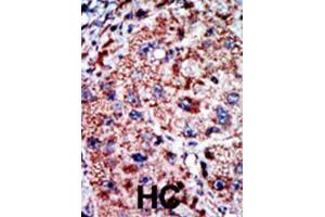 Immunohistochemistry (IHC) image for anti-Phosphofructokinase, Liver (PFKL) antibody (ABIN3003704) (PFKL Antikörper)