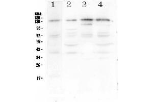 Western blot analysis of EPS15 using anti-EPS15 antibody . (EPS15 Antikörper  (AA 2-88))