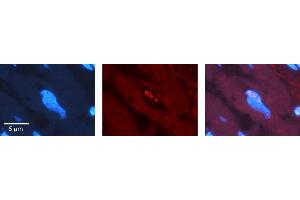 Rabbit Anti-SRSF1 Antibody   Formalin Fixed Paraffin Embedded Tissue: Human heart Tissue Observed Staining: Nucleus Primary Antibody Concentration: 1:100 Other Working Concentrations: N/A Secondary Antibody: Donkey anti-Rabbit-Cy3 Secondary Antibody Concentration: 1:200 Magnification: 20X Exposure Time: 0. (SRSF1 Antikörper  (C-Term))