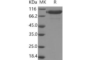 Western Blotting (WB) image for Interleukin 6 Receptor, alpha (IL6RA) protein (Fc Tag,ECD) (ABIN7196591)